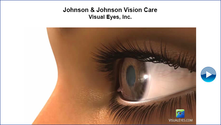 Johnson & Johnson Vision Care